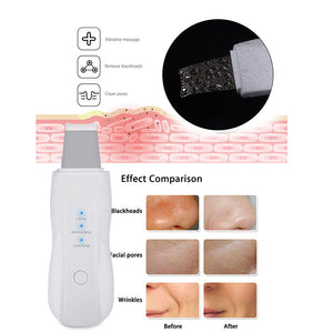 Deep Face Cleaning Vibrate Skin Scrubber